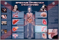 Электрифицированный стенд "Вредные привычки: алкоголизм" - «globural.ru» - Ступино